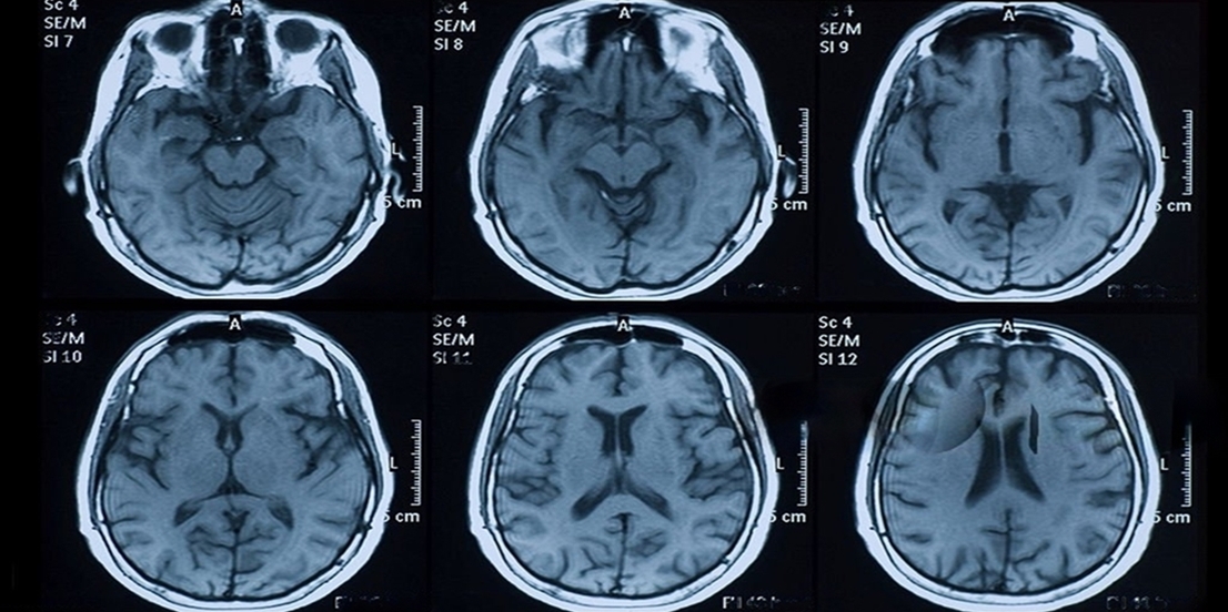 Medical Image Annotation